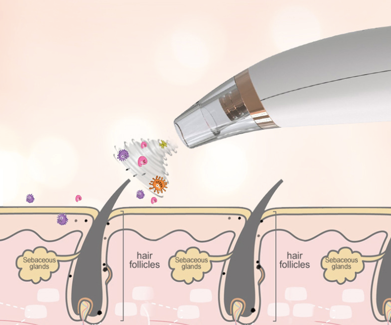 Electric Blackhead Remover